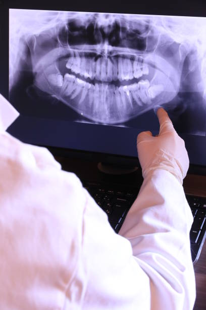 Best Emergency Wisdom Teeth Removal in Richwood, LA
