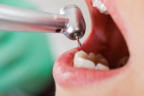 Best Emergency Treatment for Toothache in Richwood, LA